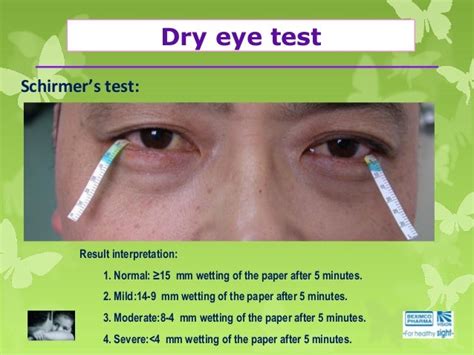 schirmer's test interpretation